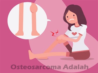 Osteosarcoma-Adalah