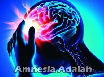 Amnesia-Adalah