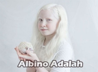 Albino-Adalah