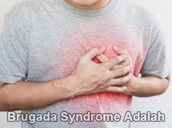 Brugada-Syndrome-Adalah